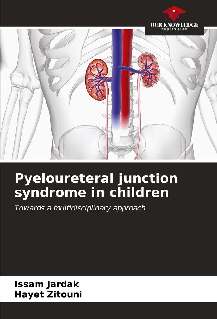 Pyeloureteral junction syndrome in children