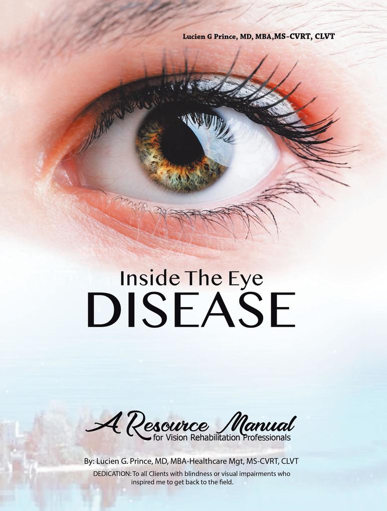 Inside the Eye Disease Just the Facts