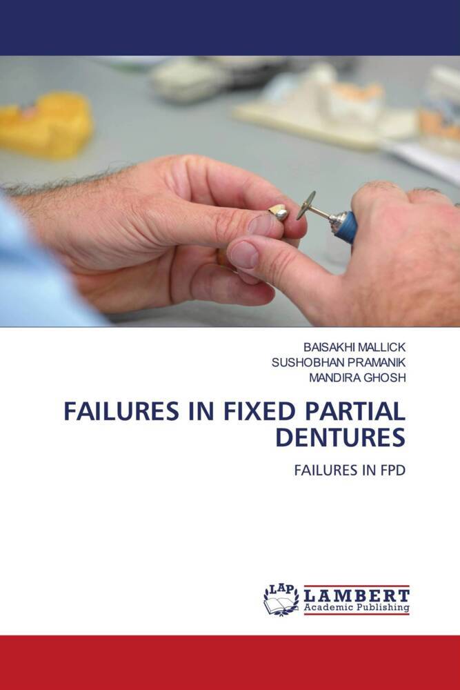 FAILURES IN FIXED PARTIAL DENTURES
