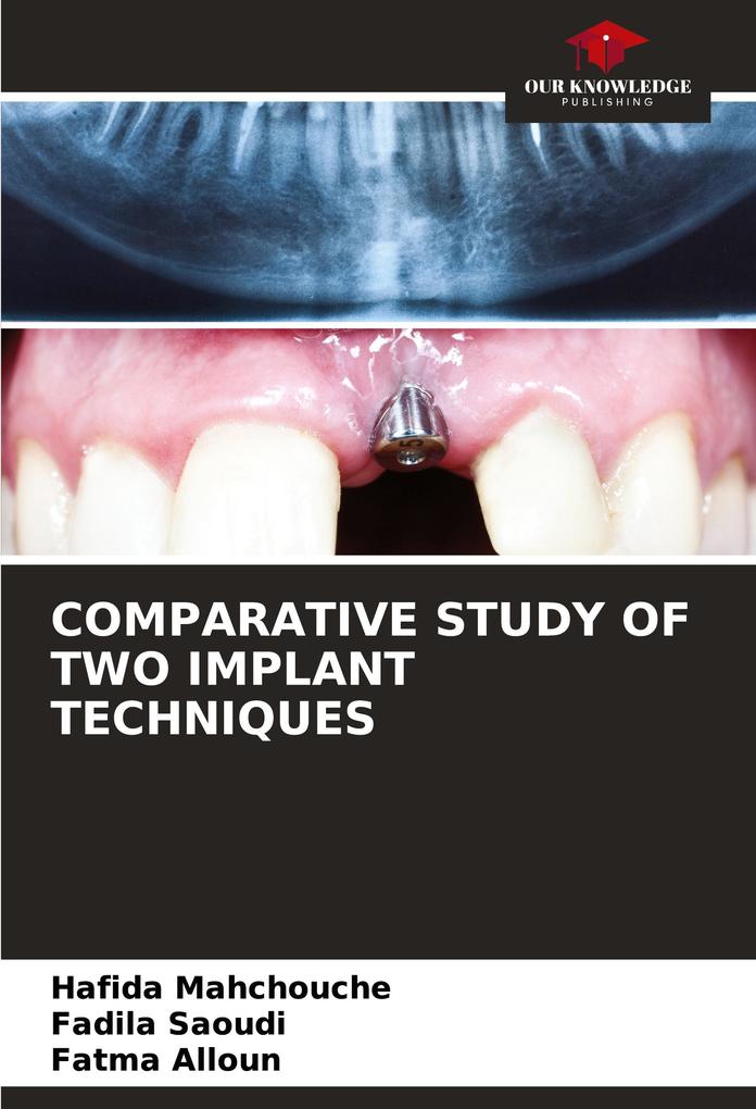 COMPARATIVE STUDY OF TWO IMPLANT TECHNIQUES