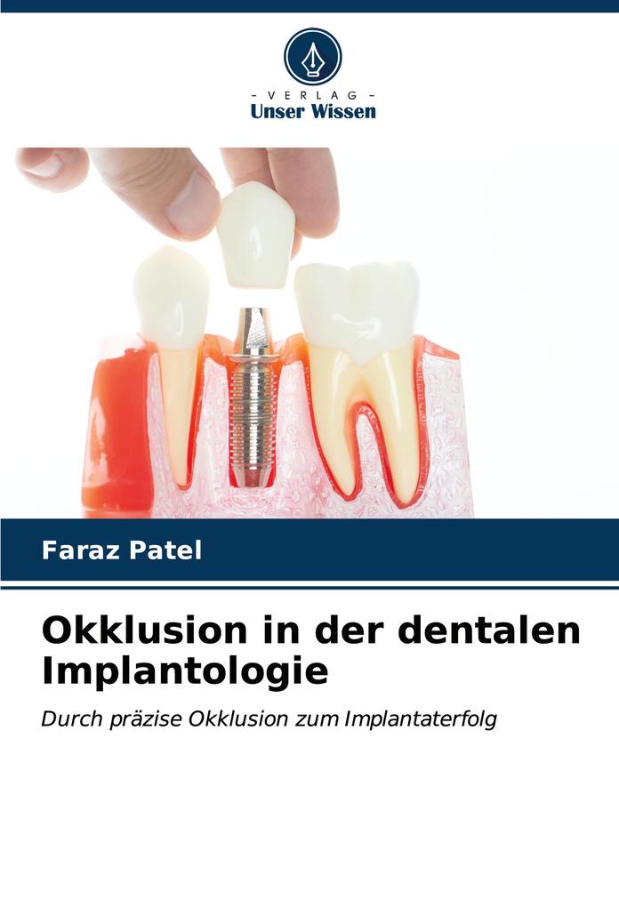 Okklusion in der dentalen Implantologie