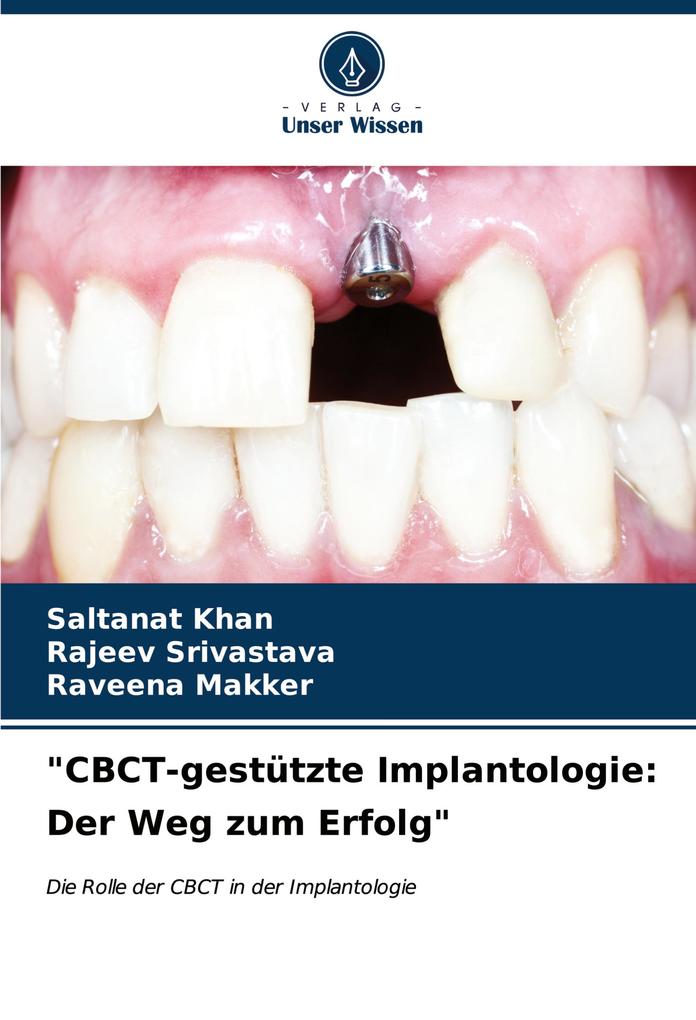 'CBCT-gestützte Implantologie: Der Weg zum Erfolg'
