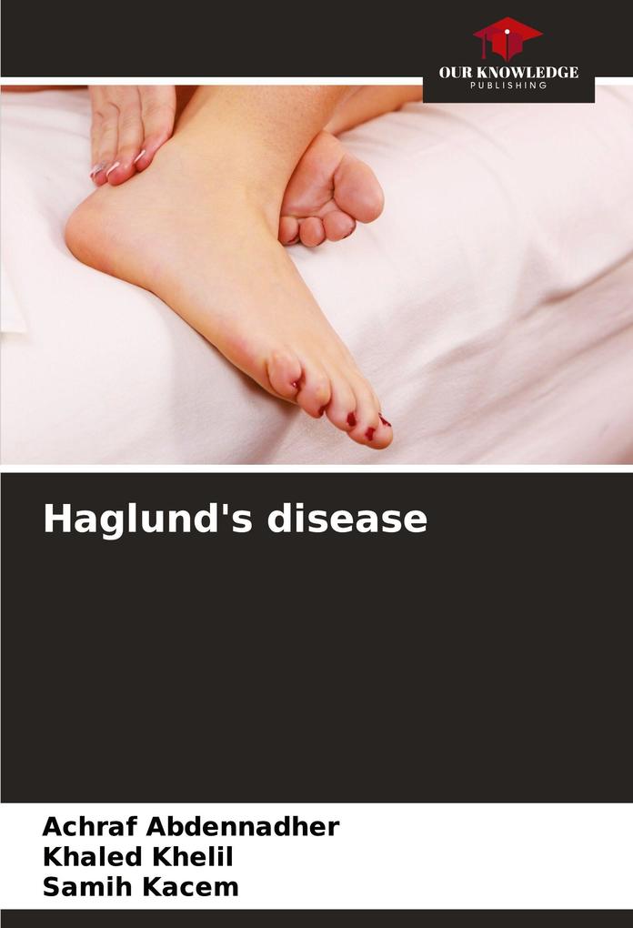 Haglund's disease