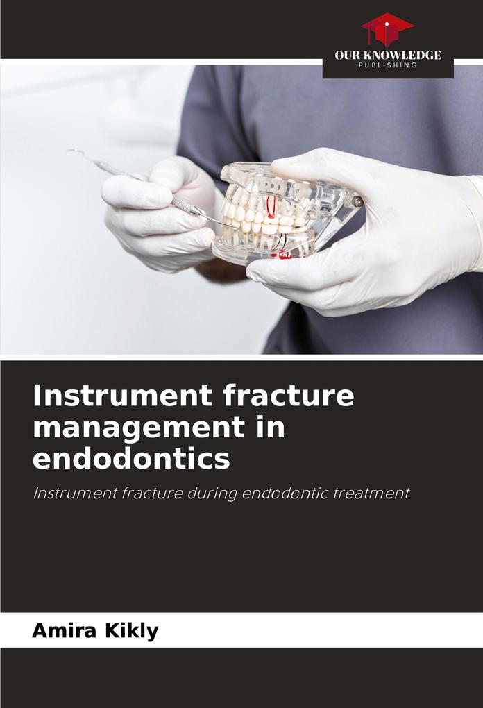 Instrument fracture management in endodontics