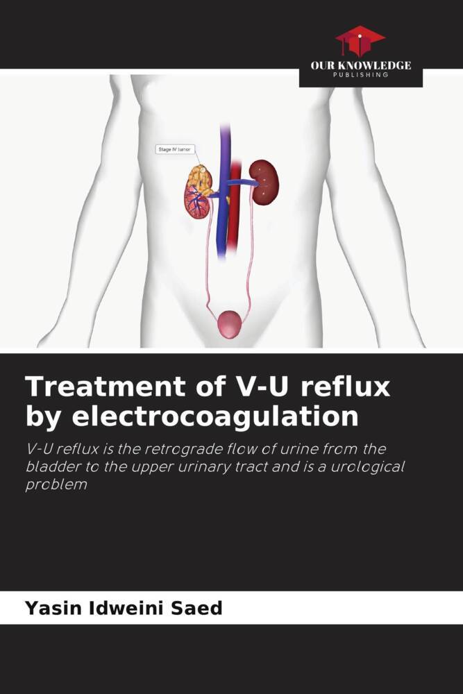Treatment of V-U reflux by electrocoagulation