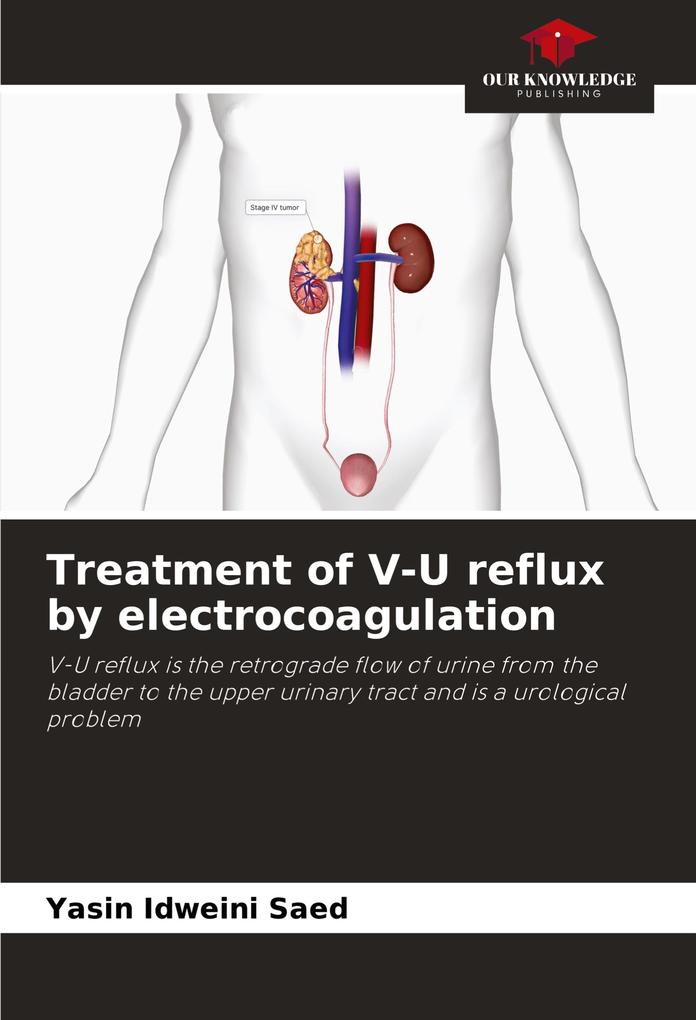 Treatment of V-U reflux by electrocoagulation
