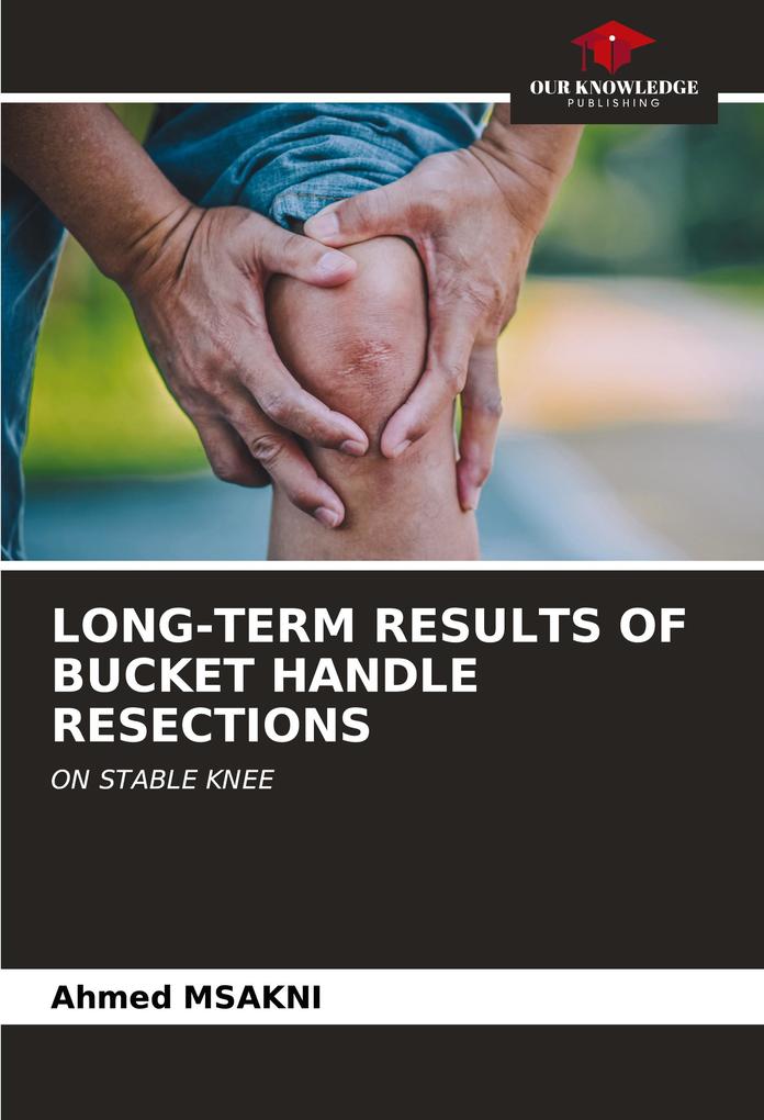 LONG-TERM RESULTS OF BUCKET HANDLE RESECTIONS