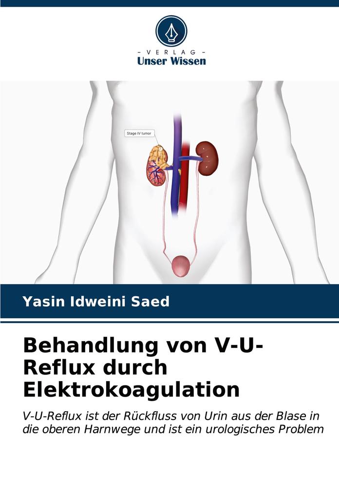 Behandlung von V-U-Reflux durch Elektrokoagulation