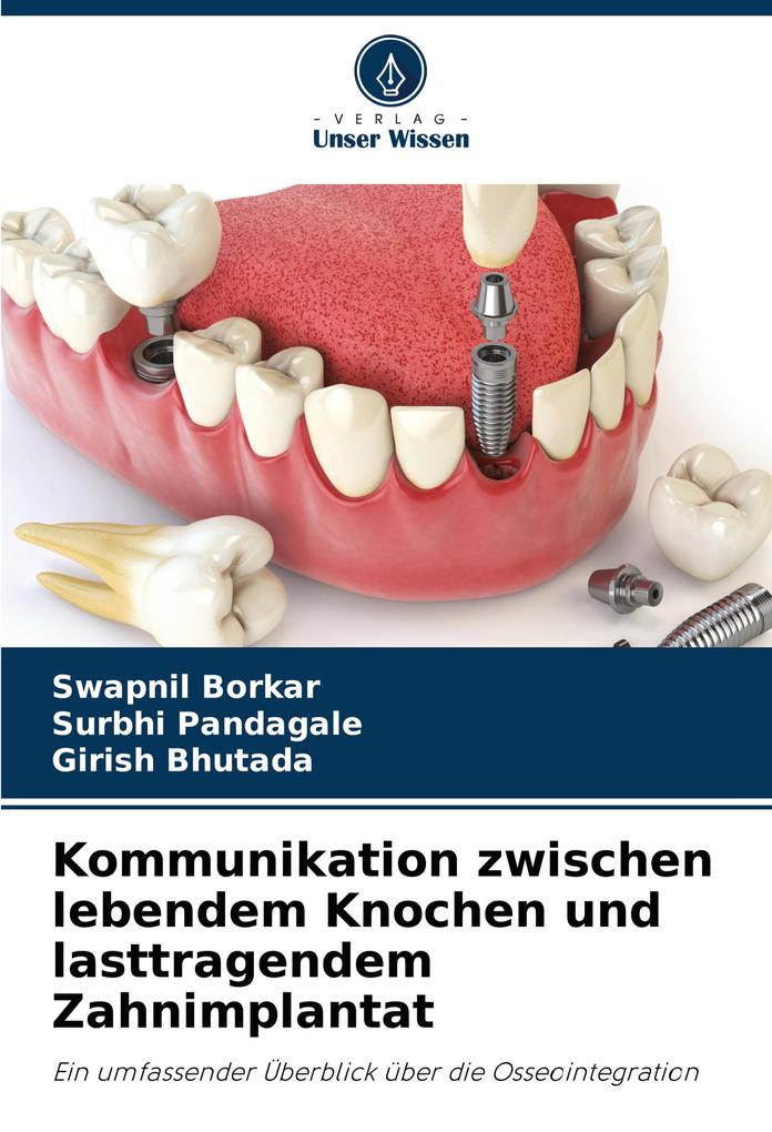 Kommunikation zwischen lebendem Knochen und lasttragendem Zahnimplantat