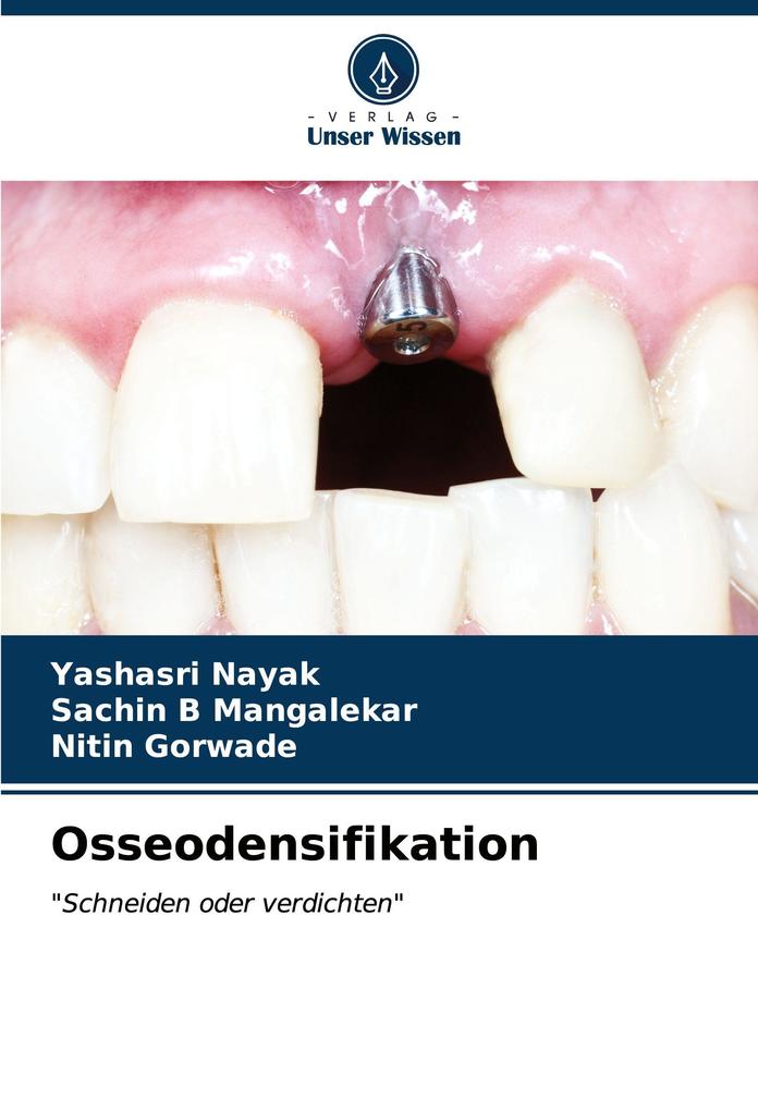 Osseodensifikation