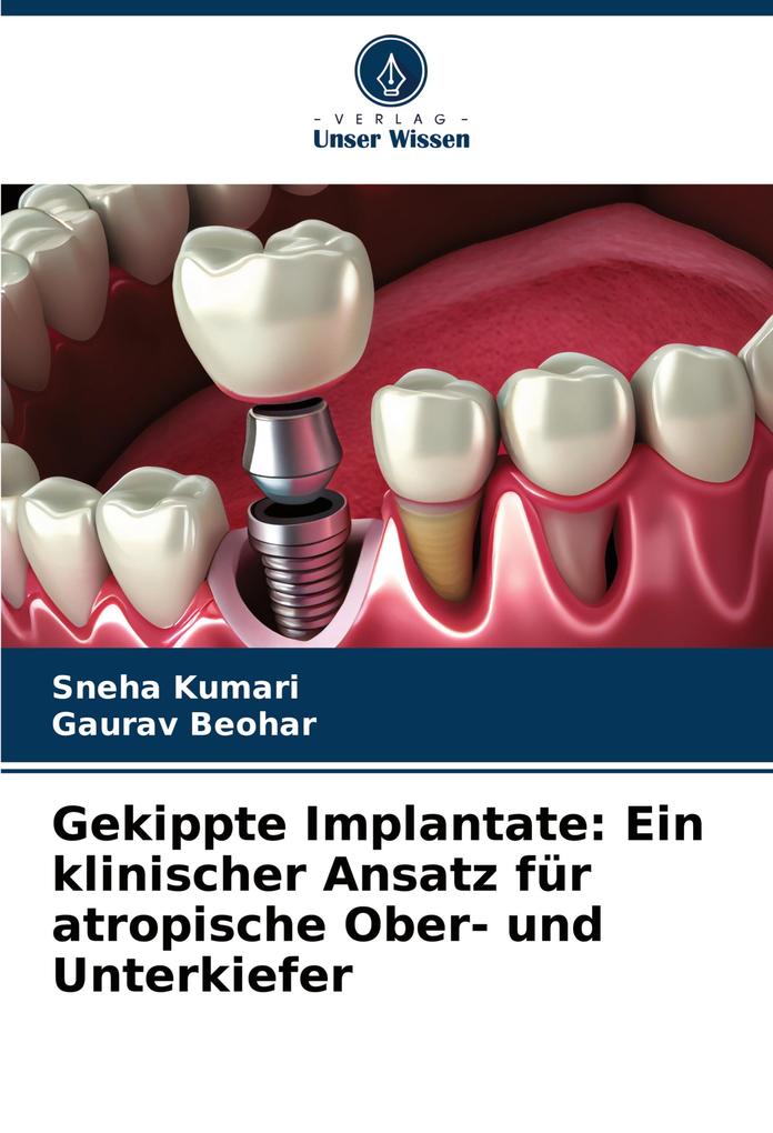 Gekippte Implantate: Ein klinischer Ansatz für atropische Ober- und Unterkiefer