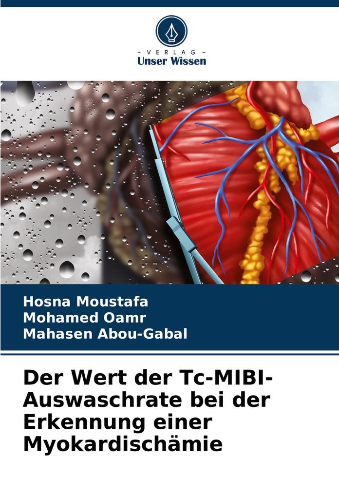 Der Wert der Tc-MIBI-Auswaschrate bei der Erkennung einer Myokardischämie