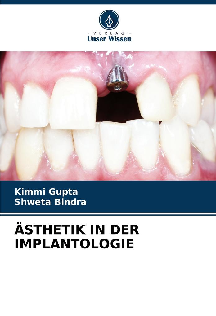 ÄSTHETIK IN DER IMPLANTOLOGIE