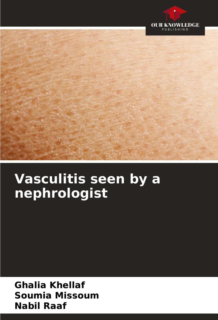 Vasculitis seen by a nephrologist