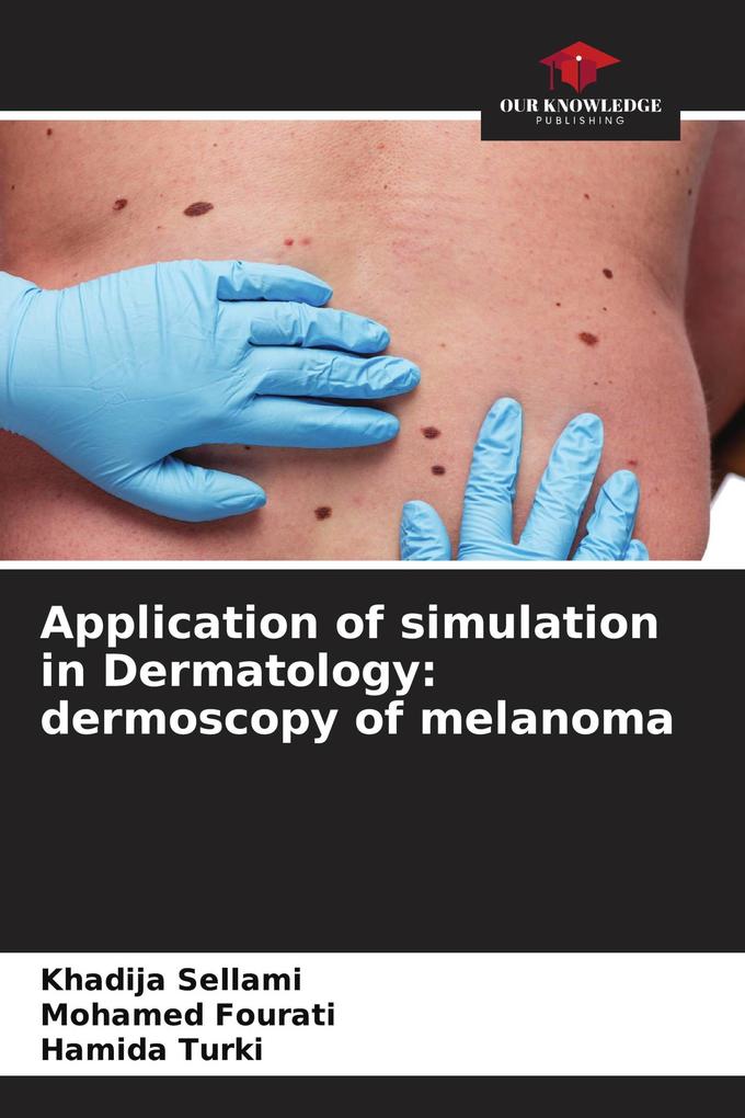 Application of simulation in Dermatology: dermoscopy of melanoma
