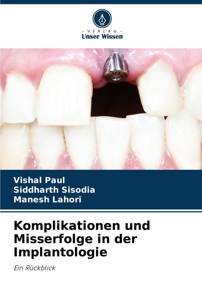 Komplikationen und Misserfolge in der Implantologie