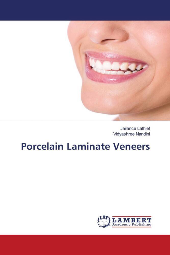 Porcelain Laminate Veneers