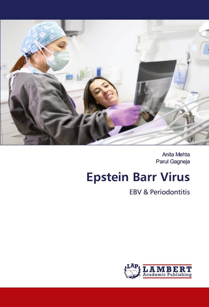 Epstein Barr Virus