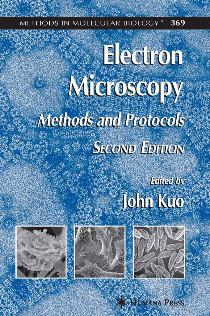 Electron Microscopy