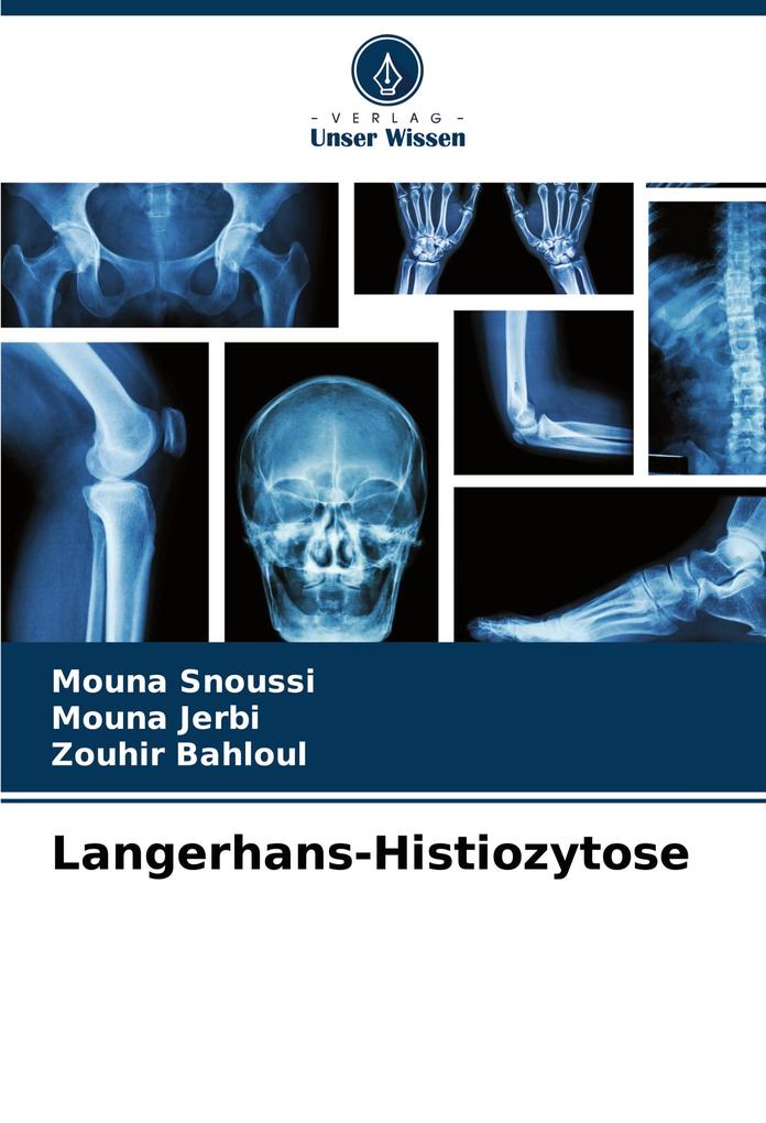 Langerhans-Histiozytose