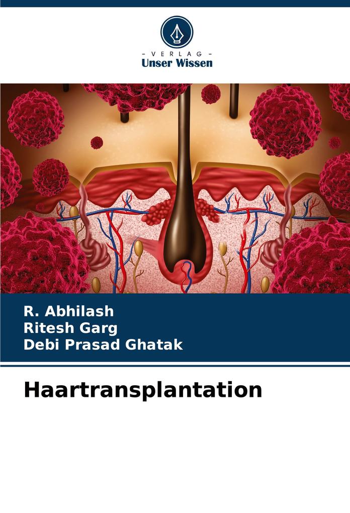 Haartransplantation