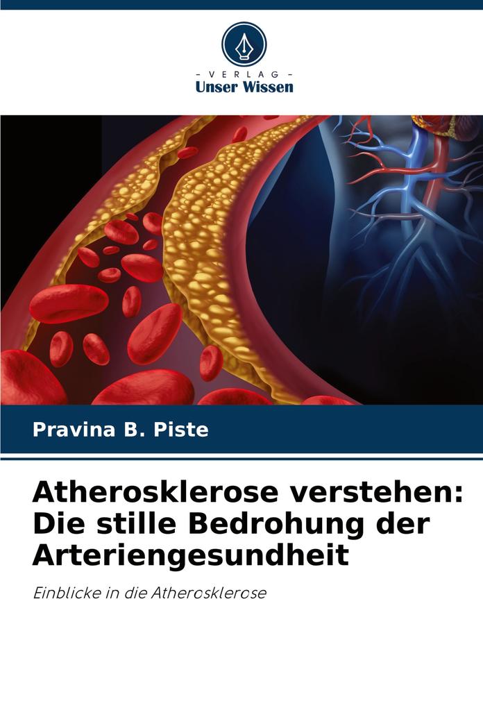 Atherosklerose verstehen: Die stille Bedrohung der Arteriengesundheit