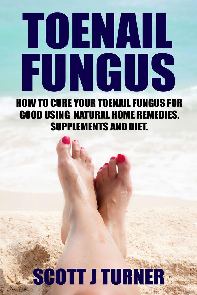 Toenail Fungus: How to Cure Your Toenail Fungus for Good using Natural Home Remedies Supplements and Diet