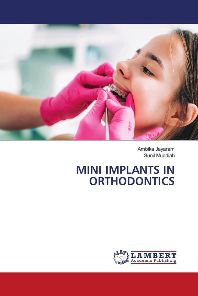 MINI IMPLANTS IN ORTHODONTICS