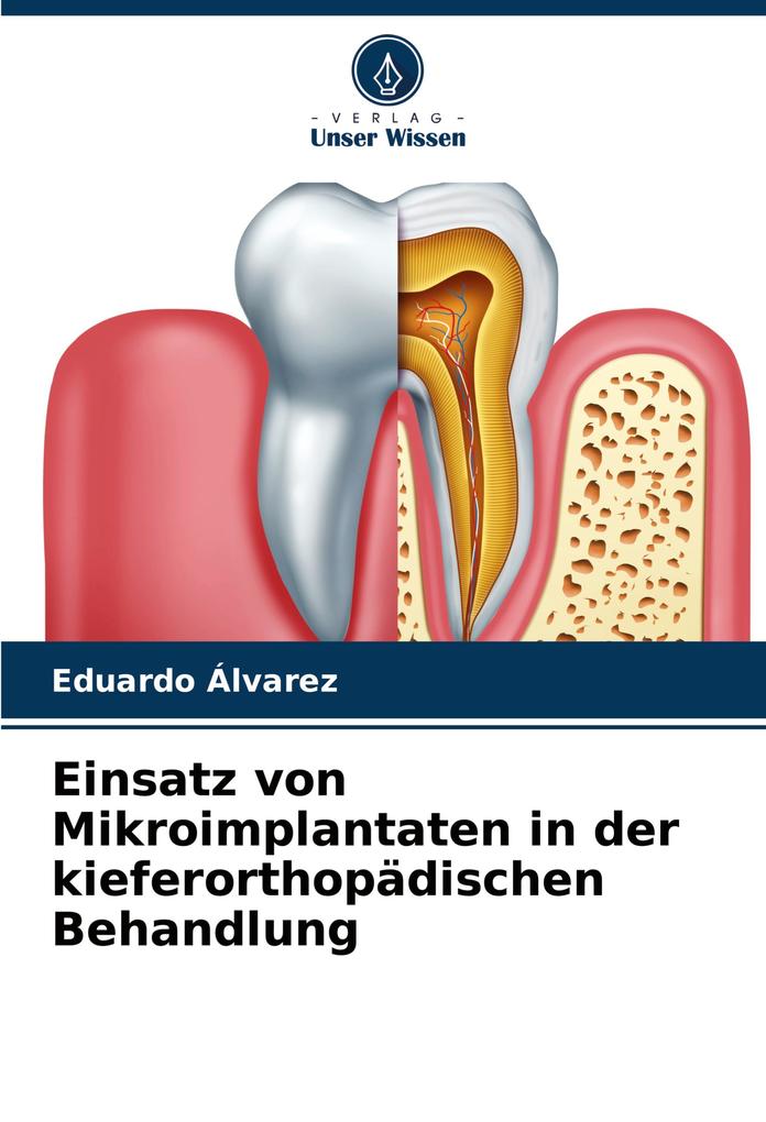 Einsatz von Mikroimplantaten in der kieferorthopädischen Behandlung