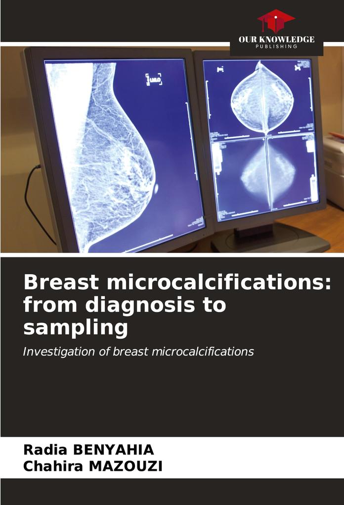 Breast microcalcifications: from diagnosis to sampling