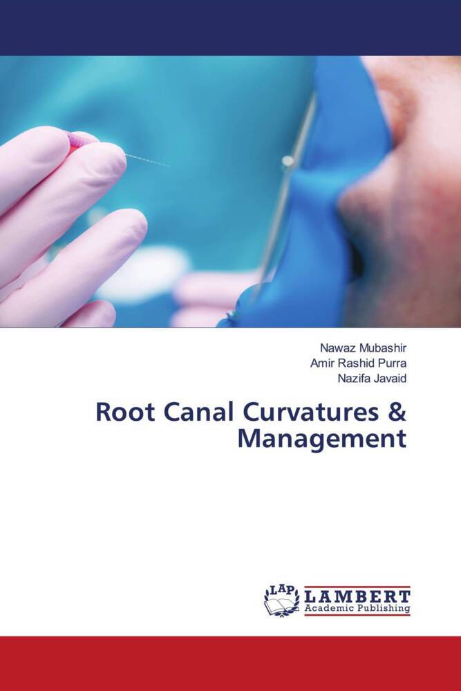 Root Canal Curvatures & Management