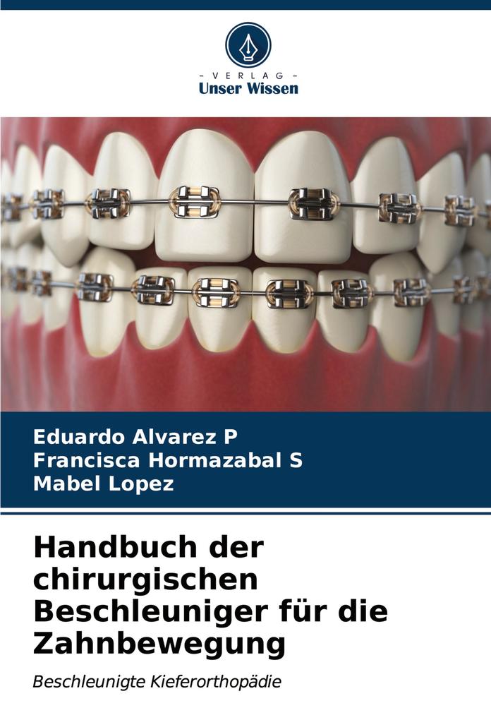 Handbuch der chirurgischen Beschleuniger für die Zahnbewegung