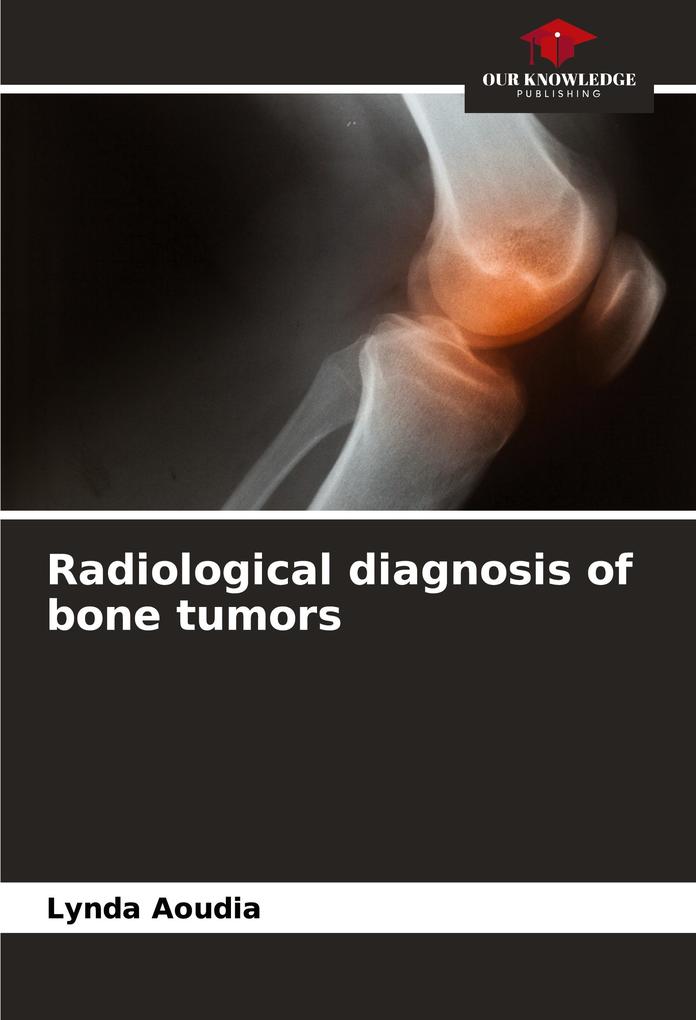 Radiological diagnosis of bone tumors
