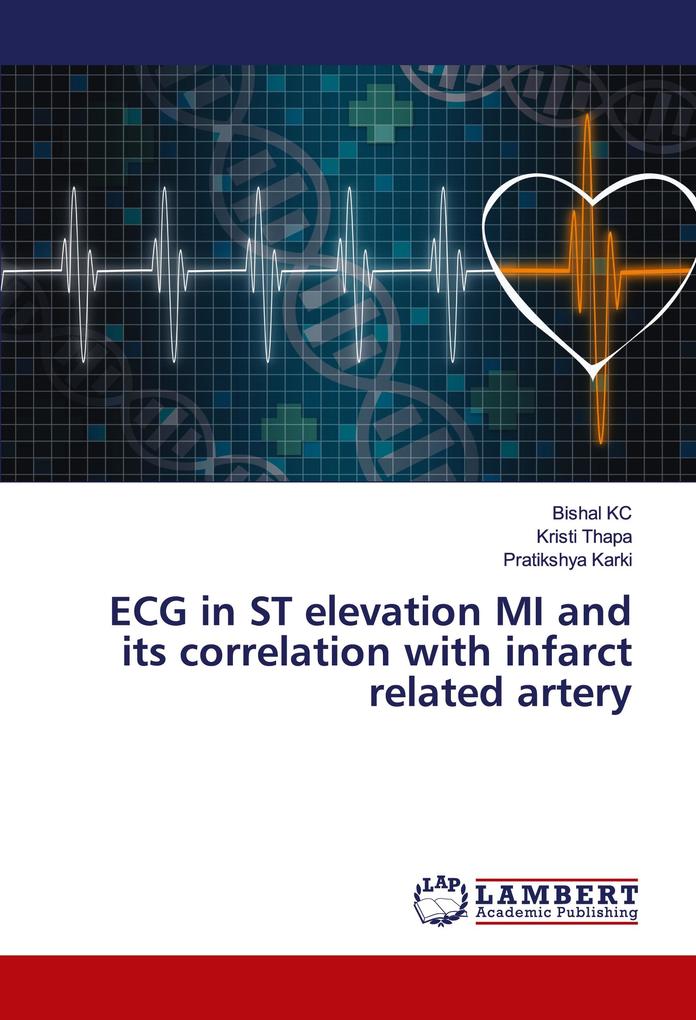 ECG in ST elevation MI and its correlation with infarct related artery