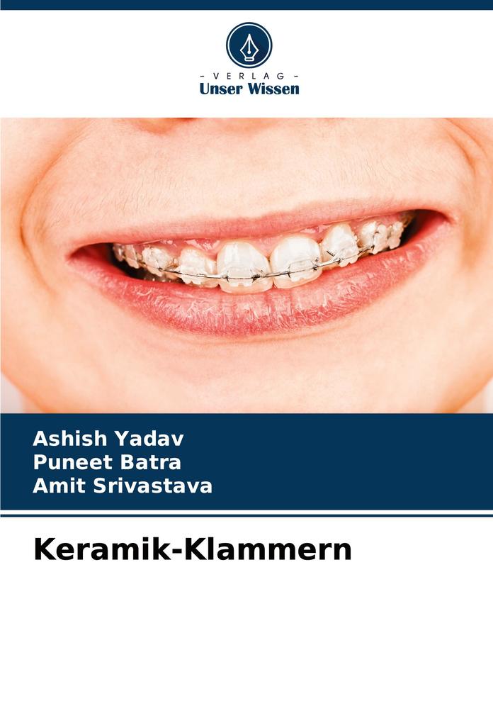 Keramik-Klammern