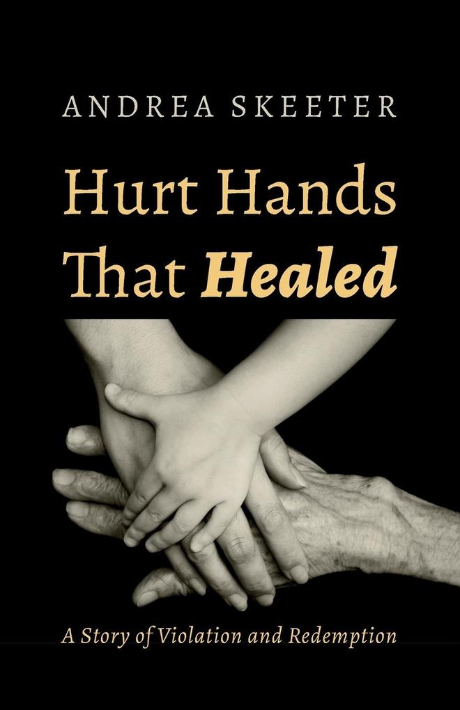 Hurt Hands That Healed