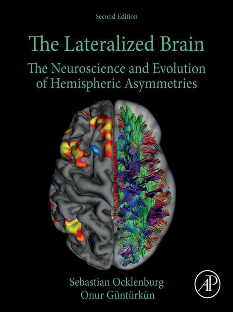 The Lateralized Brain