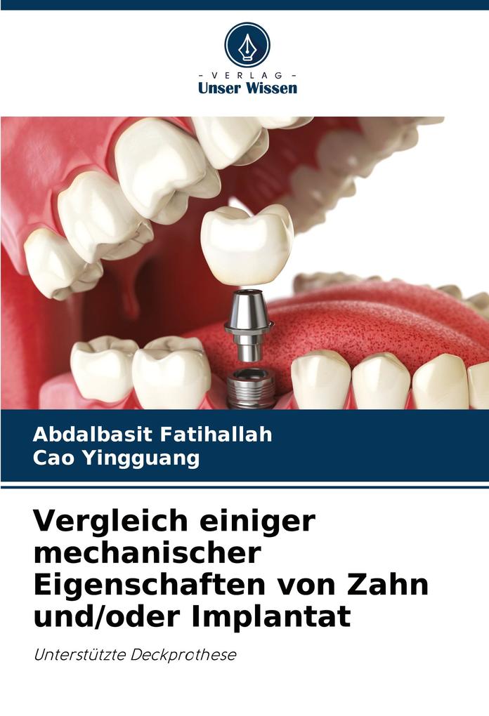 Vergleich einiger mechanischer Eigenschaften von Zahn und/oder Implantat