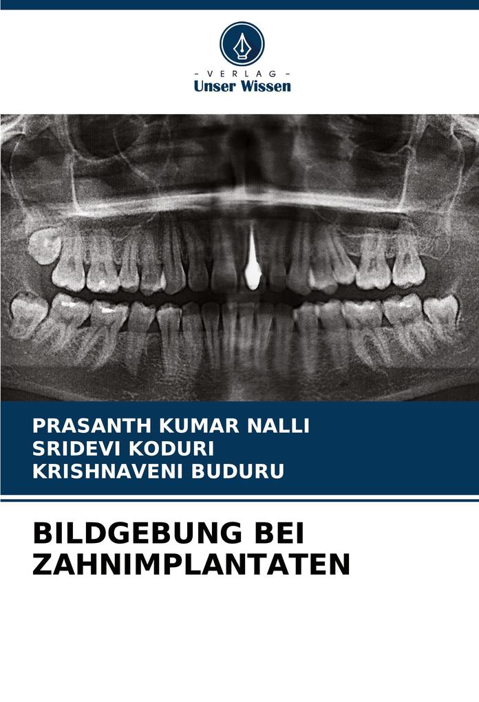 BILDGEBUNG BEI ZAHNIMPLANTATEN