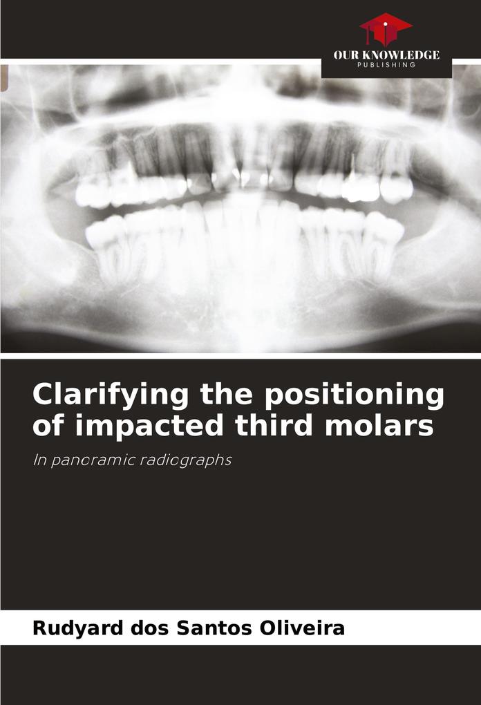 Clarifying the positioning of impacted third molars