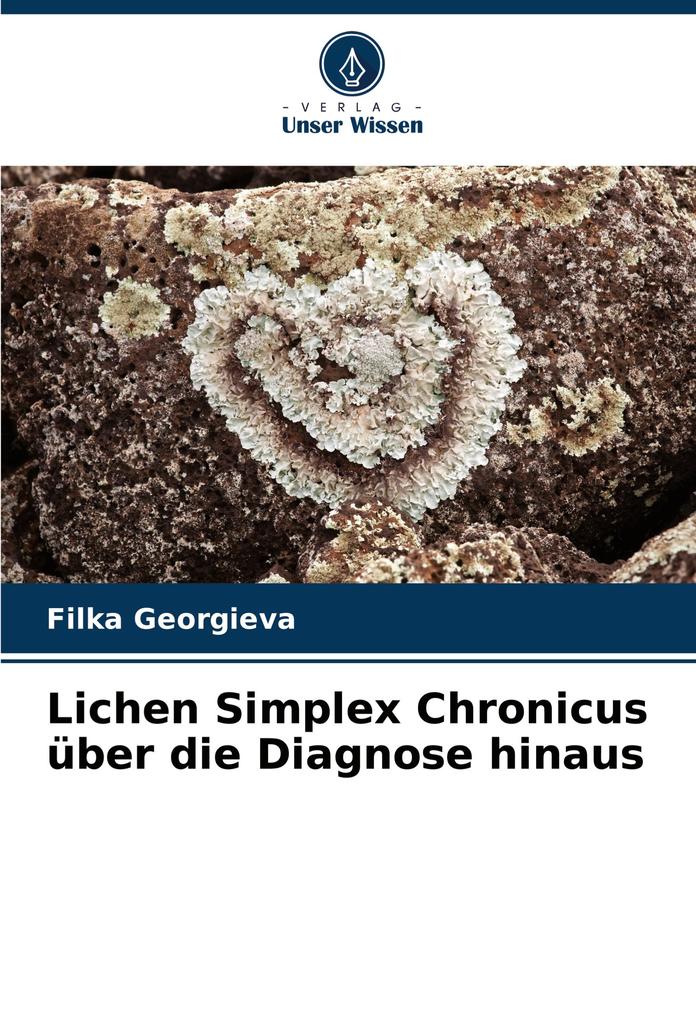 Lichen Simplex Chronicus über die Diagnose hinaus