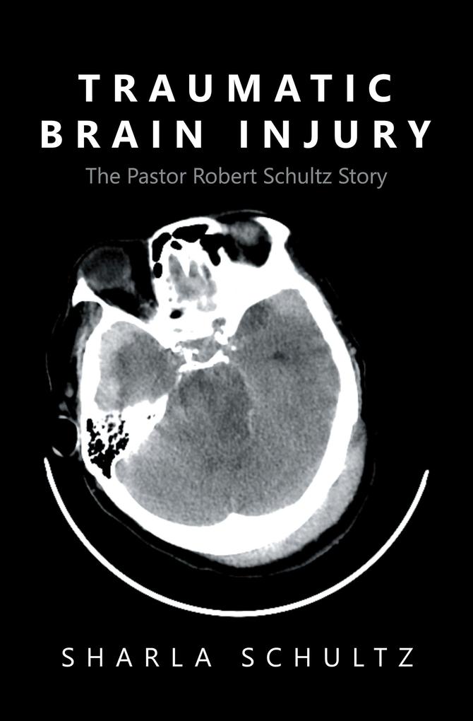 Traumatic Brain Injury