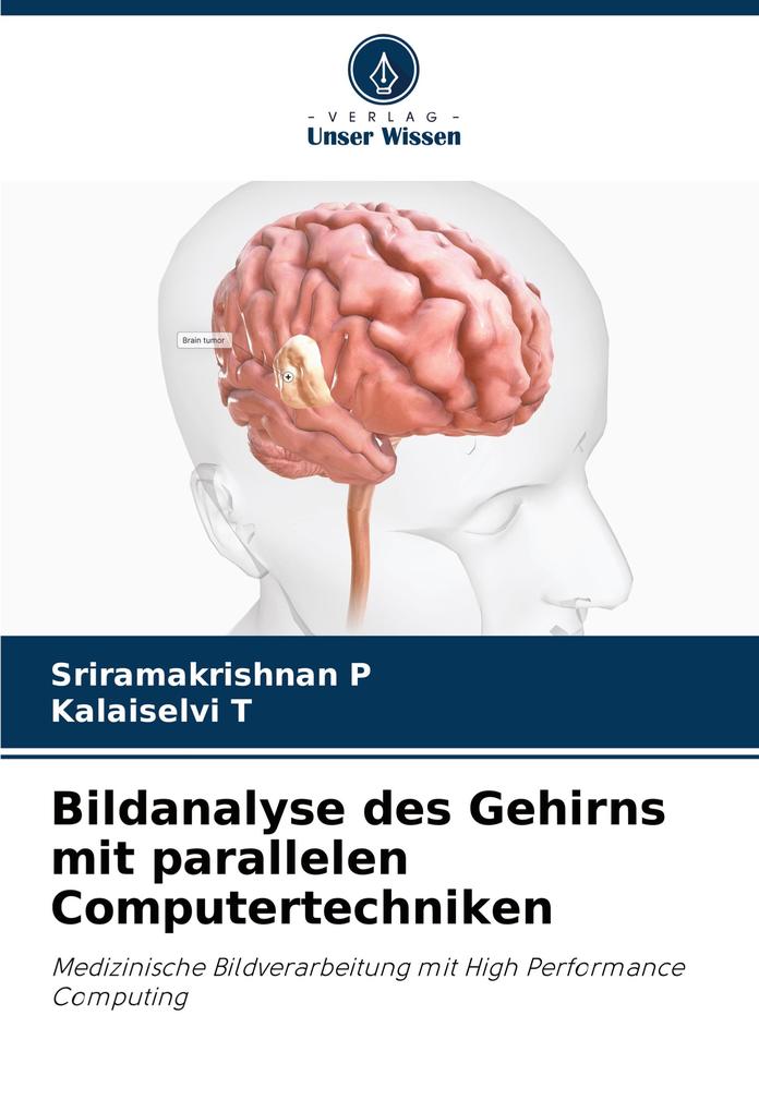 Bildanalyse des Gehirns mit parallelen Computertechniken