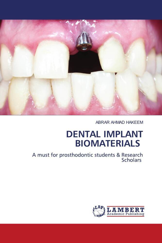 DENTAL IMPLANT BIOMATERIALS