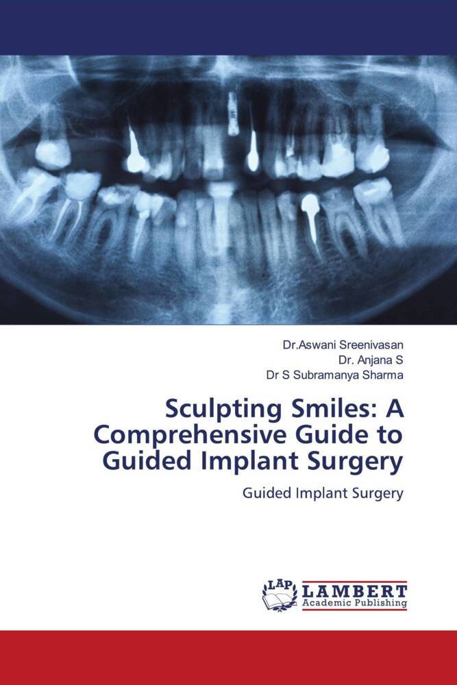Sculpting Smiles: A Comprehensive Guide to Guided Implant Surgery
