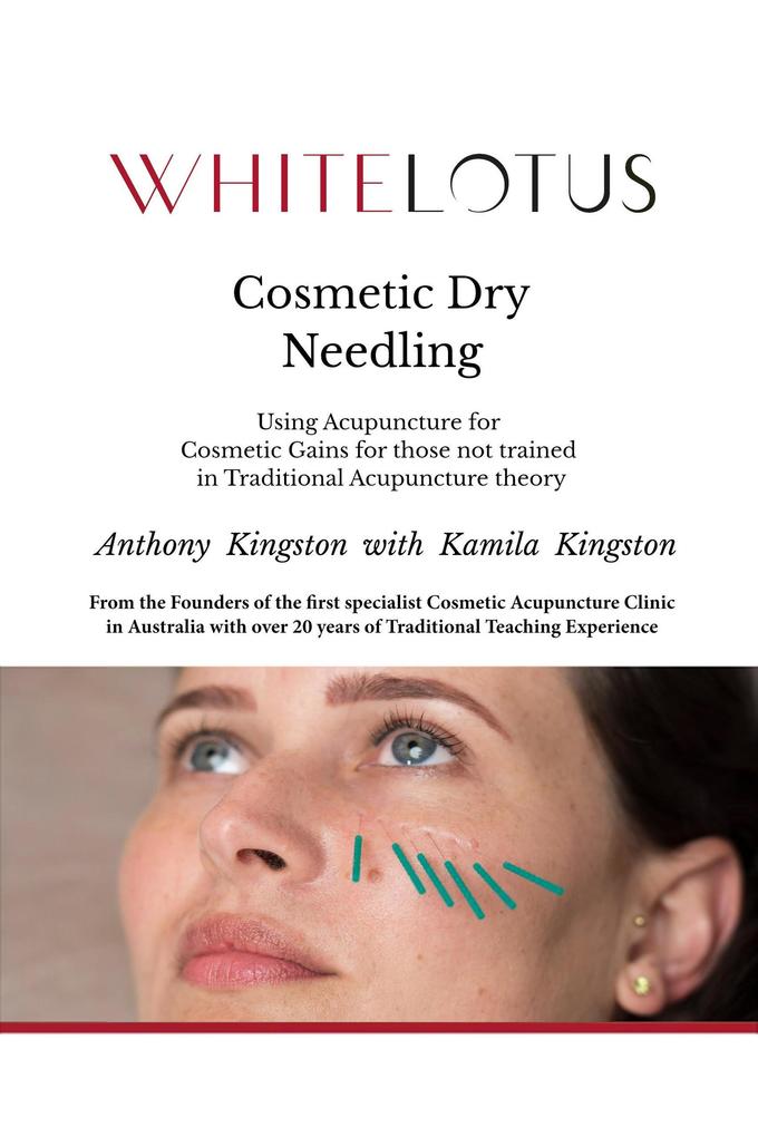 Cosmetic Dry Needling - Using Acupuncture for Cosmetic Gains for Those Not Trained in Traditional Acupuncture Theory