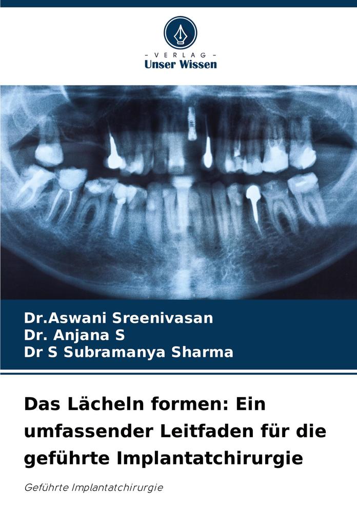 Das Lächeln formen: Ein umfassender Leitfaden für die geführte Implantatchirurgie