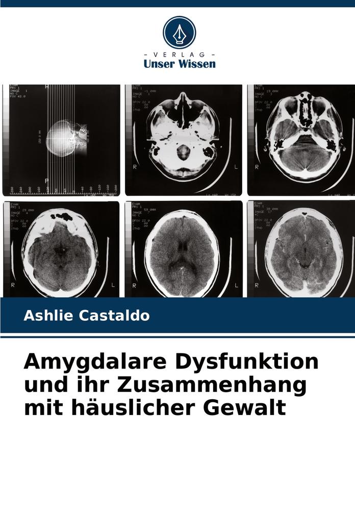 Amygdalare Dysfunktion und ihr Zusammenhang mit häuslicher Gewalt