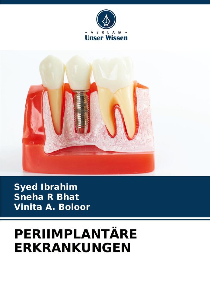PERIIMPLANTÄRE ERKRANKUNGEN