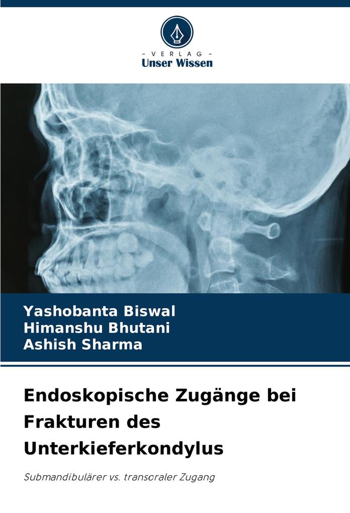 Endoskopische Zugänge bei Frakturen des Unterkieferkondylus